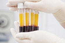 plasma donation