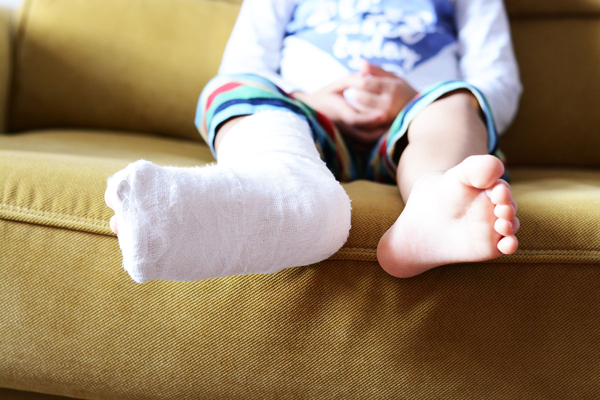 child with cast on leg