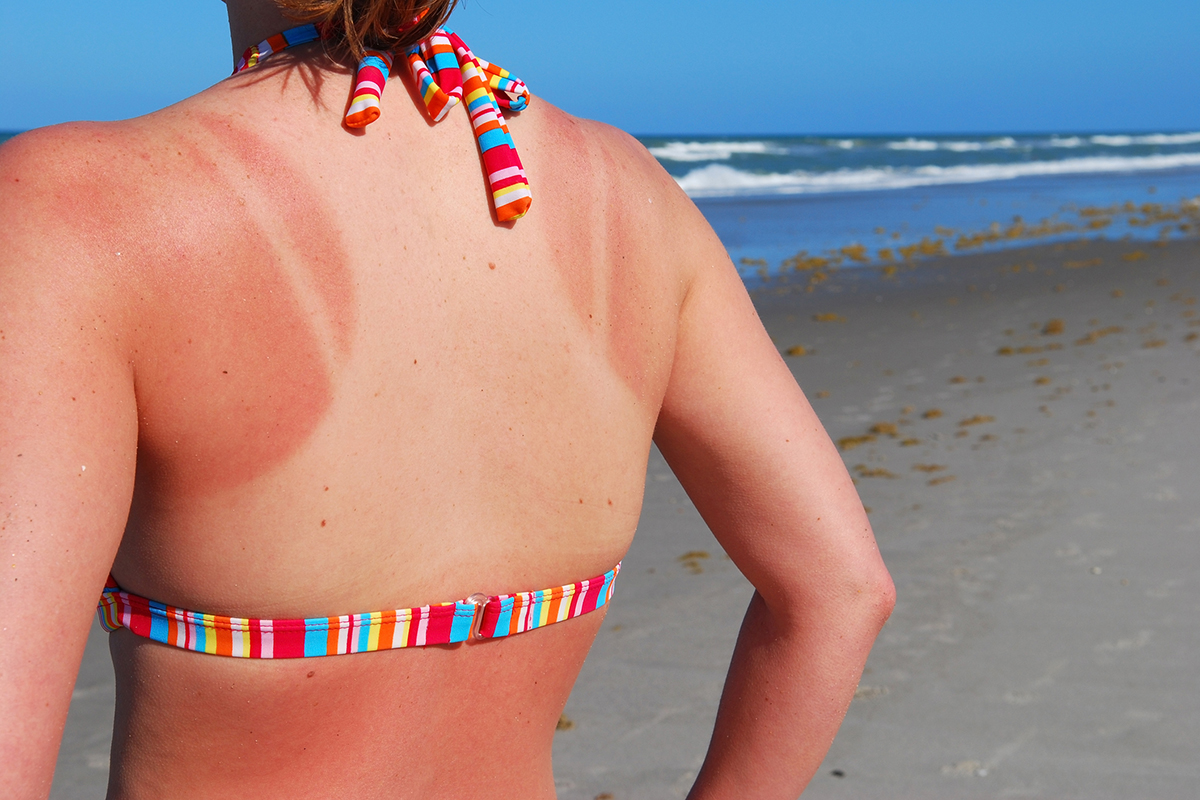 FDA warns against using unproven sunscreen pills.