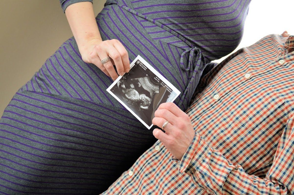 A man and woman are pictured with an ultrasound of their baby