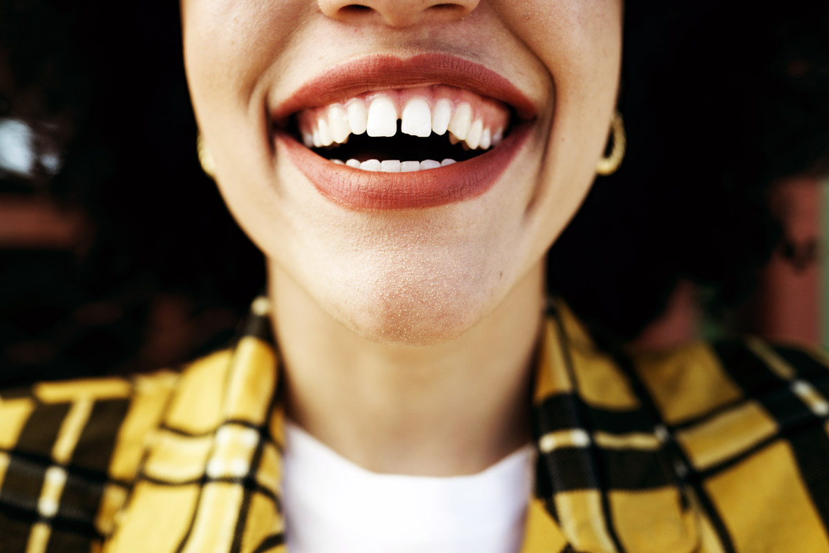 A woman smiles showing her teeth. 